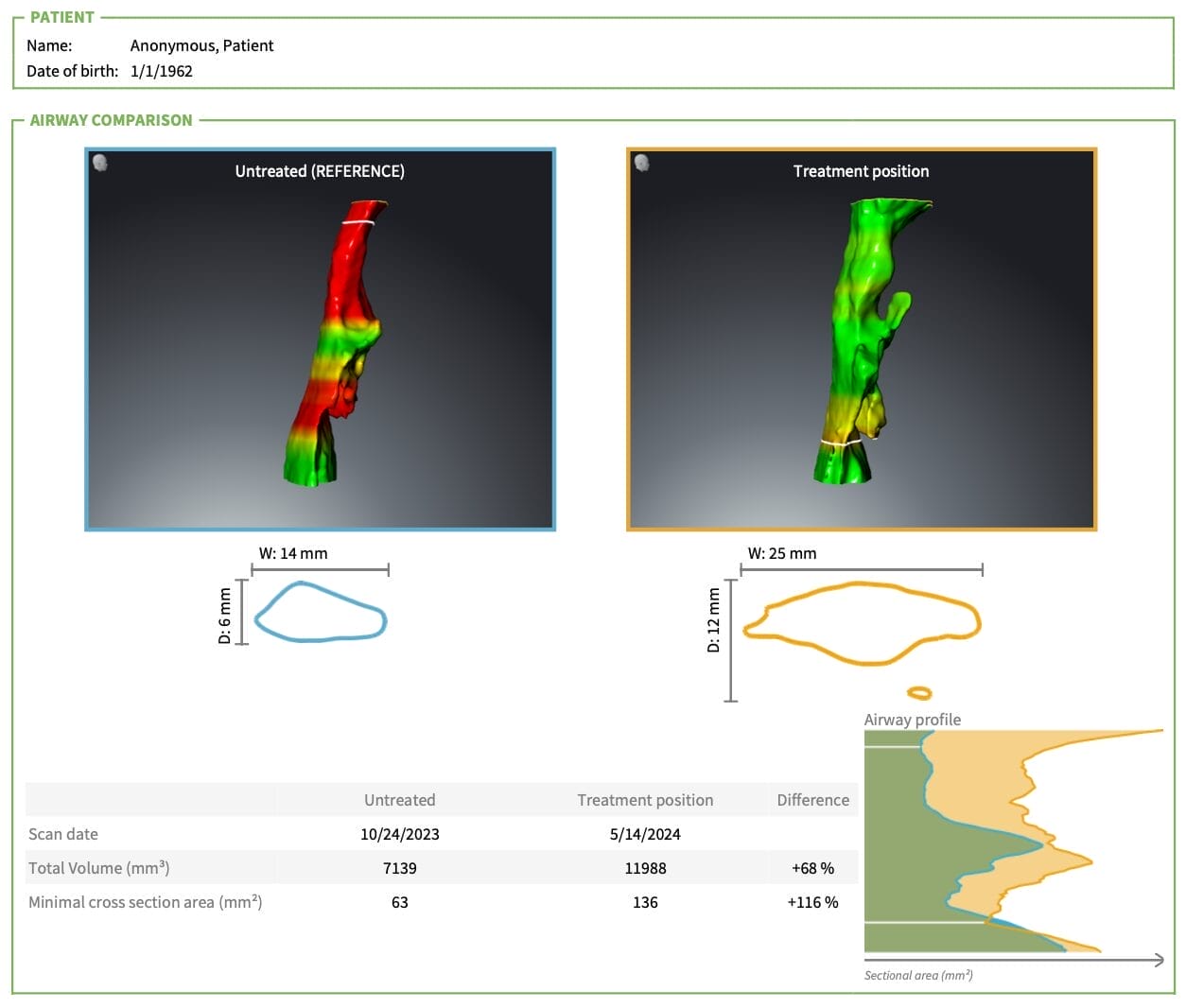case study of sleep apnea